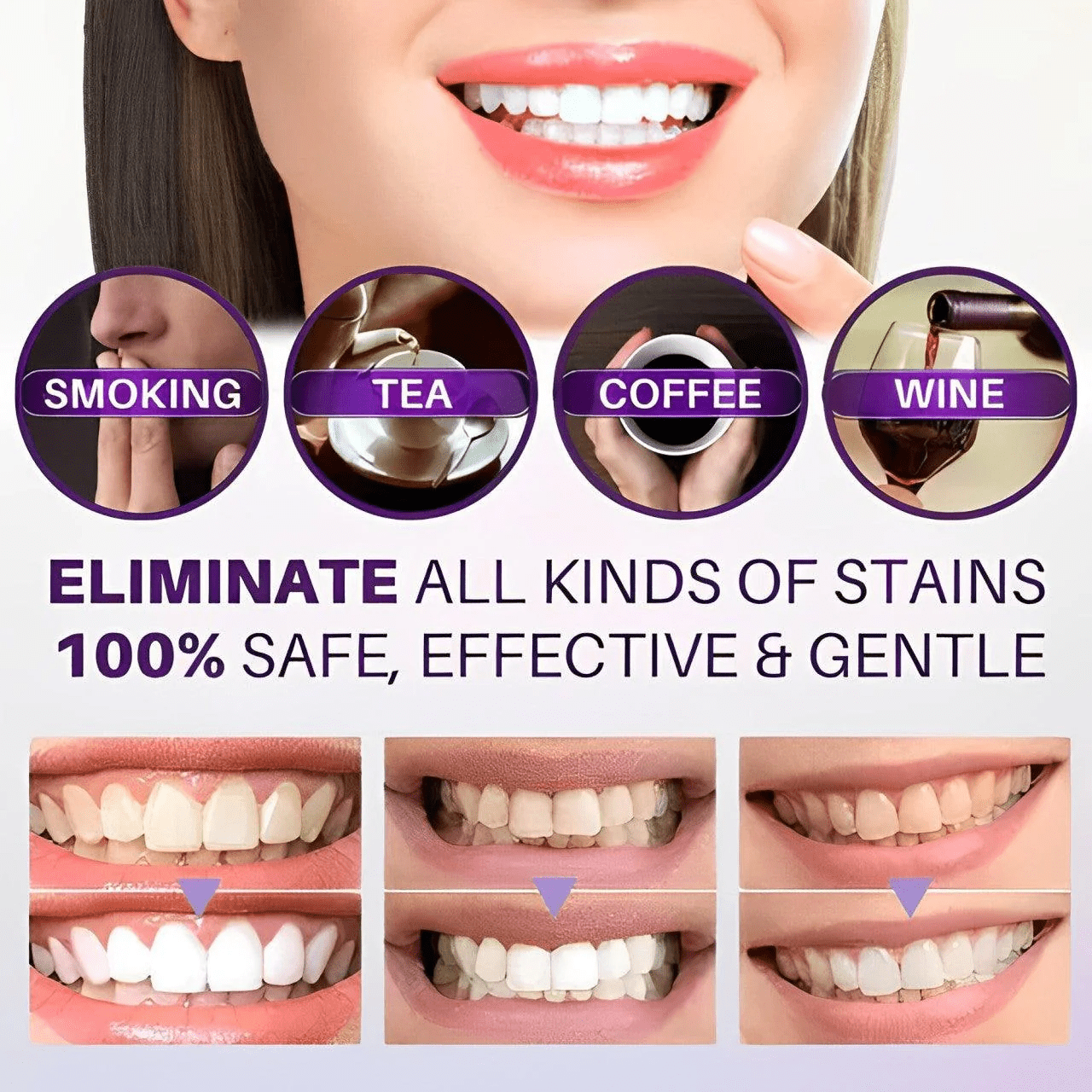 HiSmile Teeth Whitening Serum - Image 4