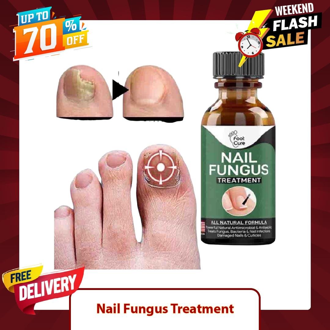nail fungus treatment price pakistan